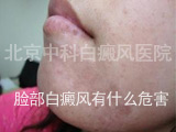 综